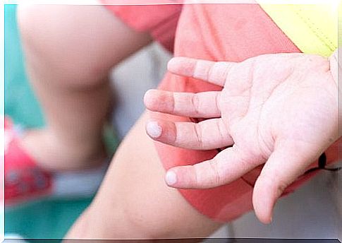 Blisters in children can have a number of causes