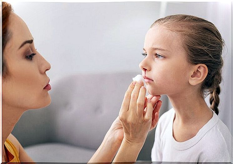 Properly treat and avoid nosebleeds in children